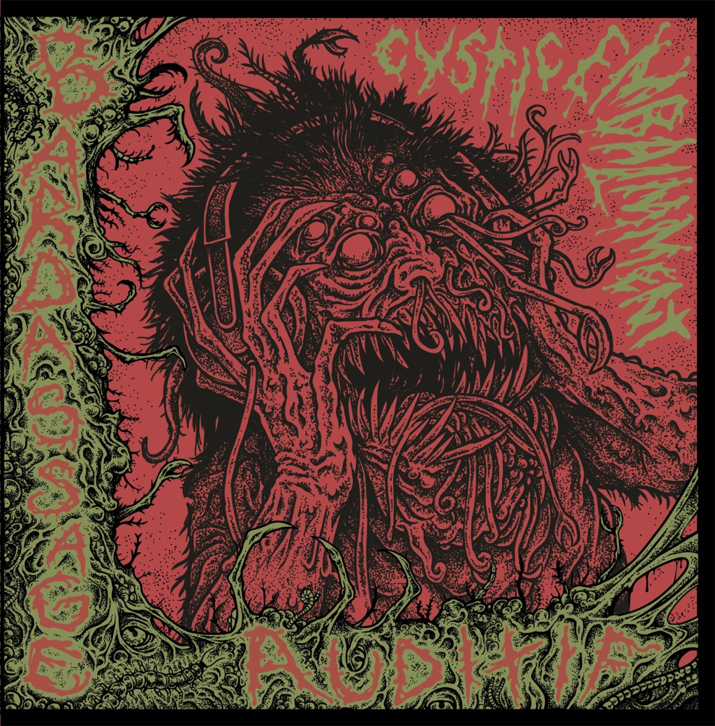 Cystic Embalmment mit Bardassange&nbsp;Auditif